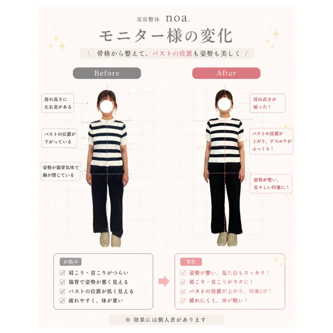 撮影モデル ばば まさみのエステ・リラクイメージ