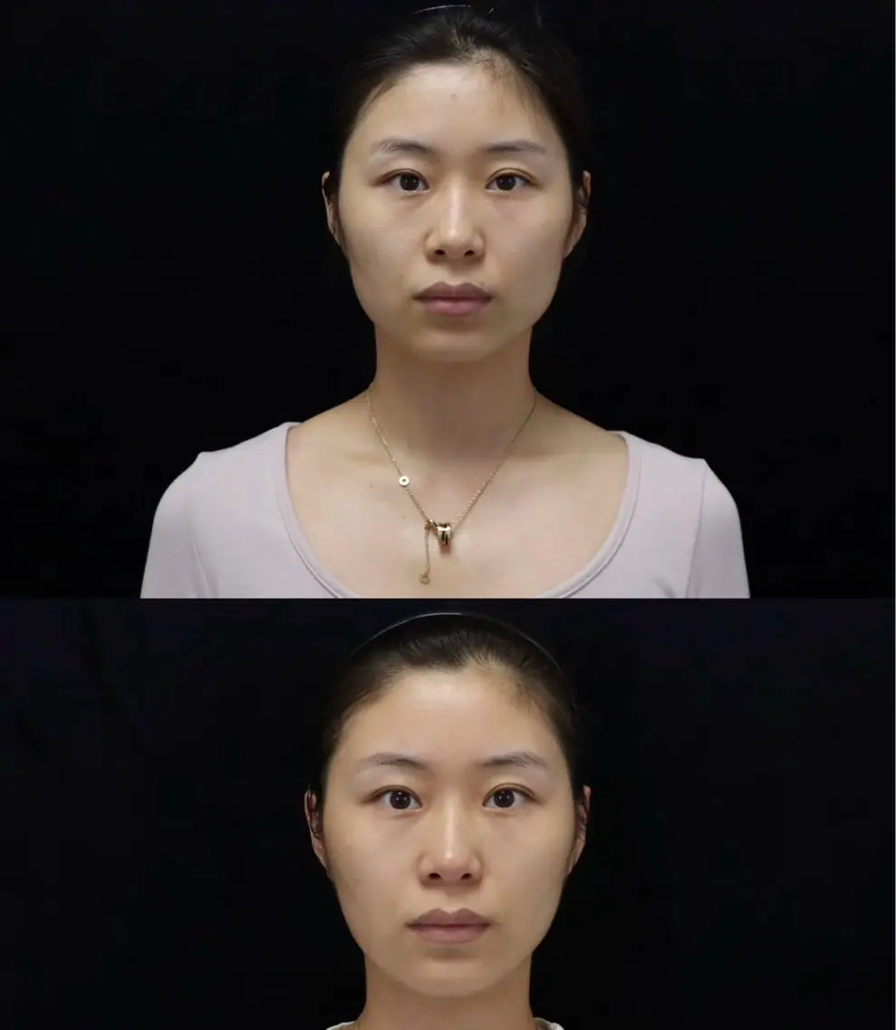 マツエク・マツパ エステ リラク 愛維美水光美肌専門店 メンズレディースokのエステ・リラクイメージ