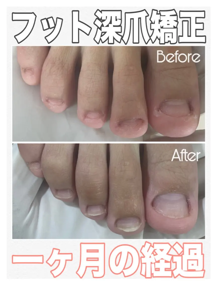 ネイル フットネイル フットネイル nail salon petillantのネイルデザイン