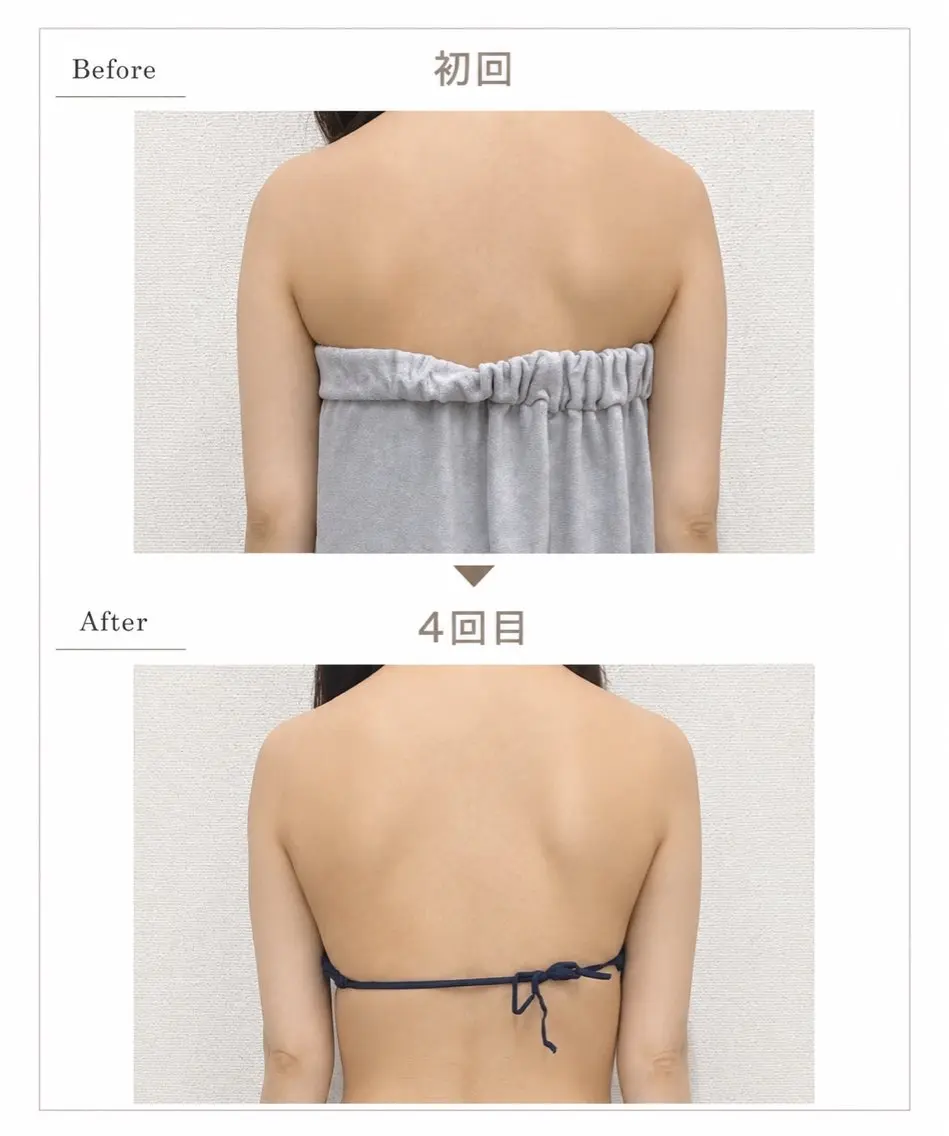 【部位別】痩身モニター様募集🍋6cc×4回【1回あたり¥12,450】の写真
