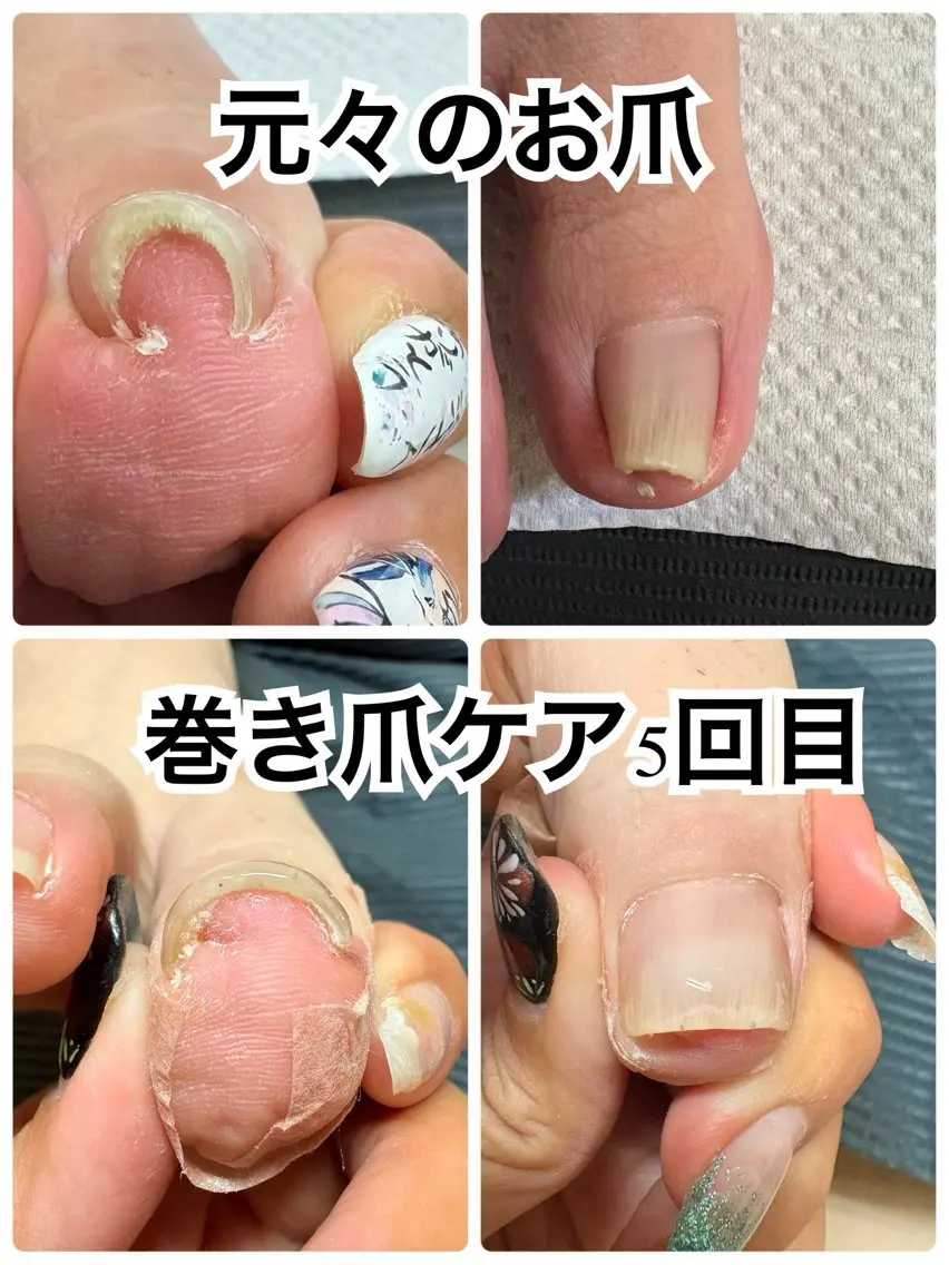 ネイル フットネイル -TOIRO- Eriのネイルデザイン
