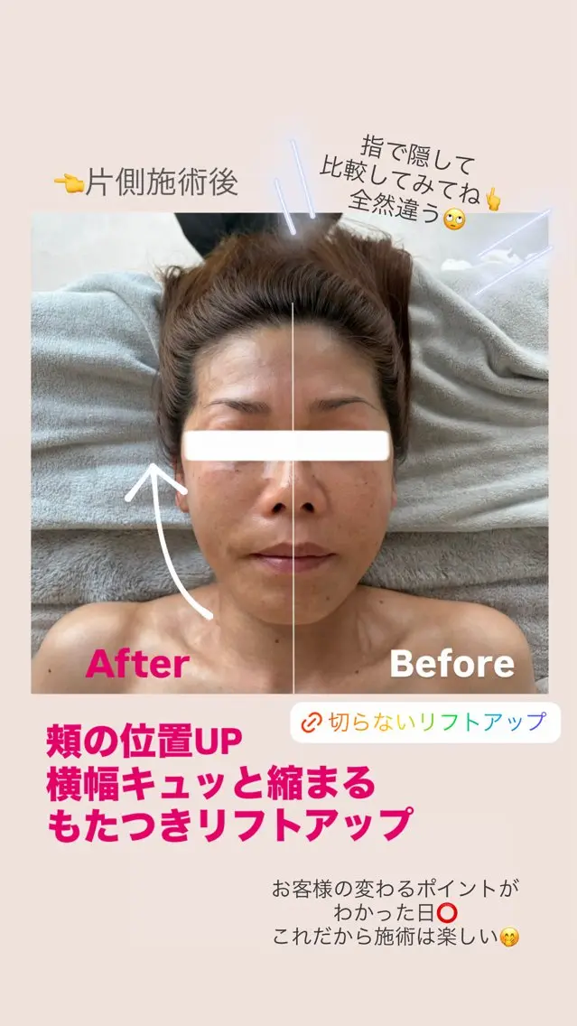 エステ たるみリフトコルギ フワリーのエステ・リラクイメージ