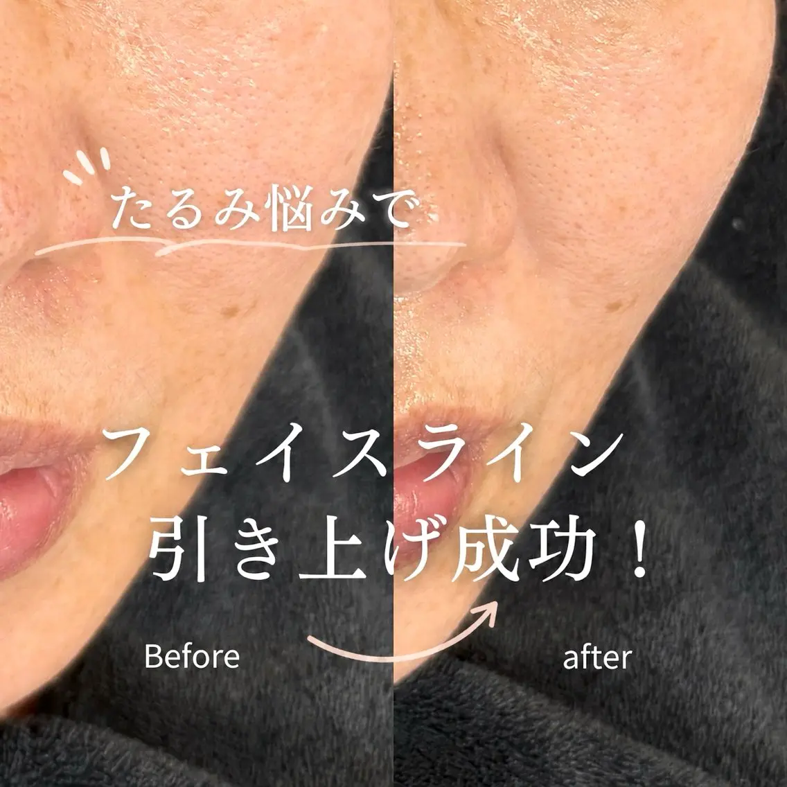 エステ Balance facialのエステ・リラクイメージ