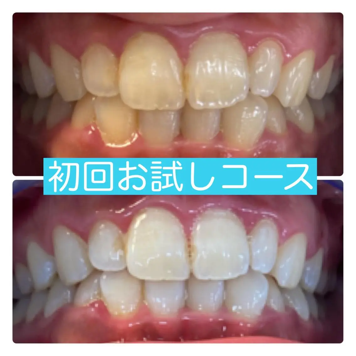 その他 ホワイトニングルーム 横浜店のその他イメージ