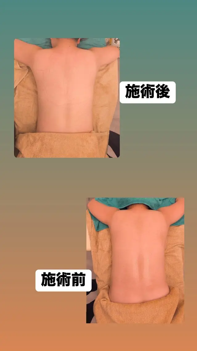 オイルを使った全身リンパマッサージ　代謝をあげダイエット効果✨の写真