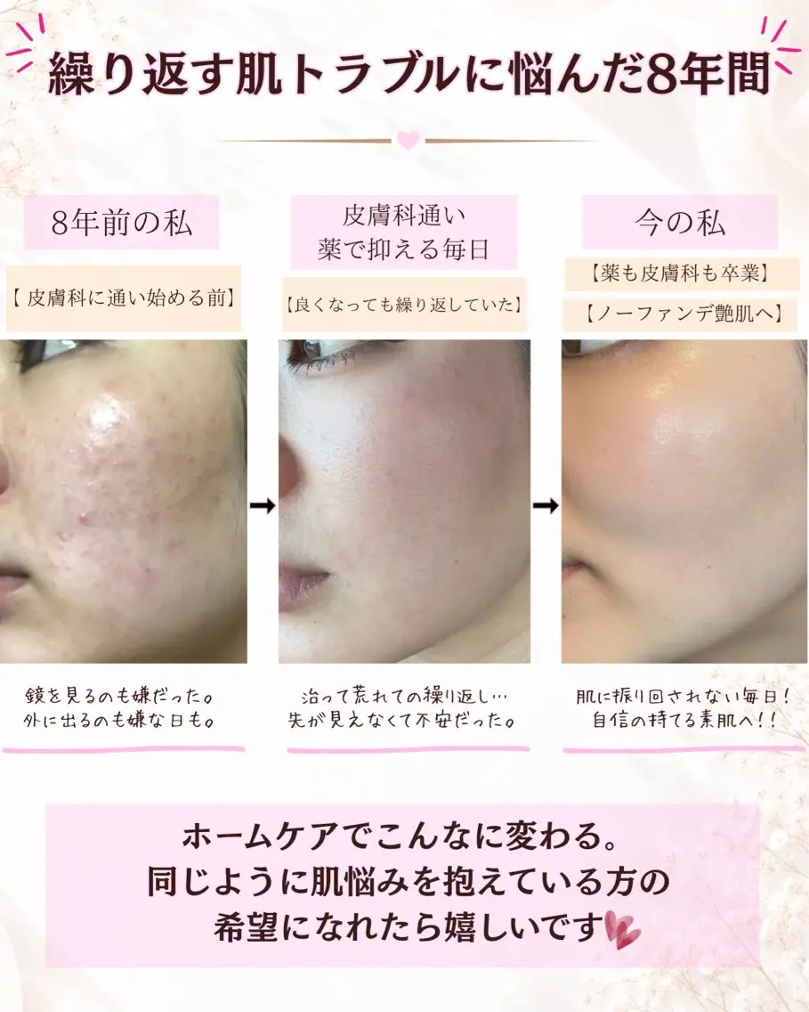肌悩み別スキンケア体験の写真