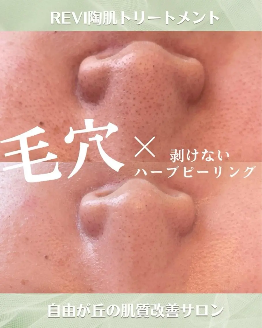 エステ ハーブピーリング専門 毛穴洗浄❤️眉waxのエステ・リラクイメージ