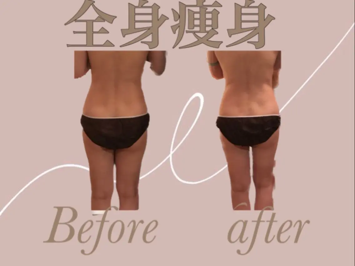 温活痩身サロン LILYのエステ・リラクイメージ
