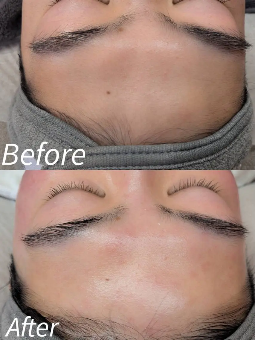 脱毛 en.  eye& facewaxのエステ・リラクイメージ