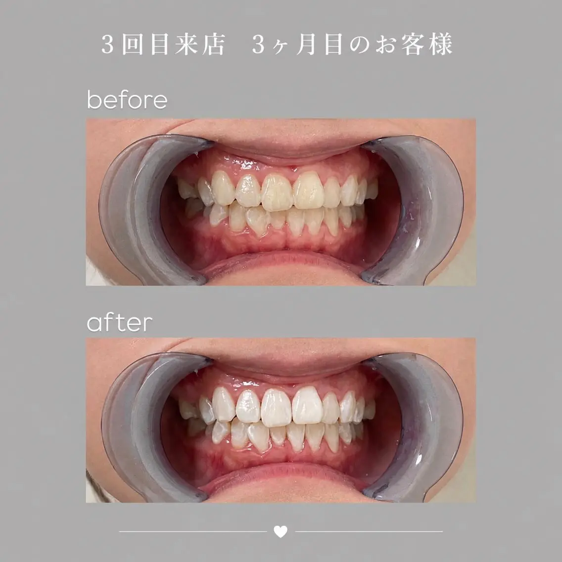 aoi 🦷❤︎のその他イメージ