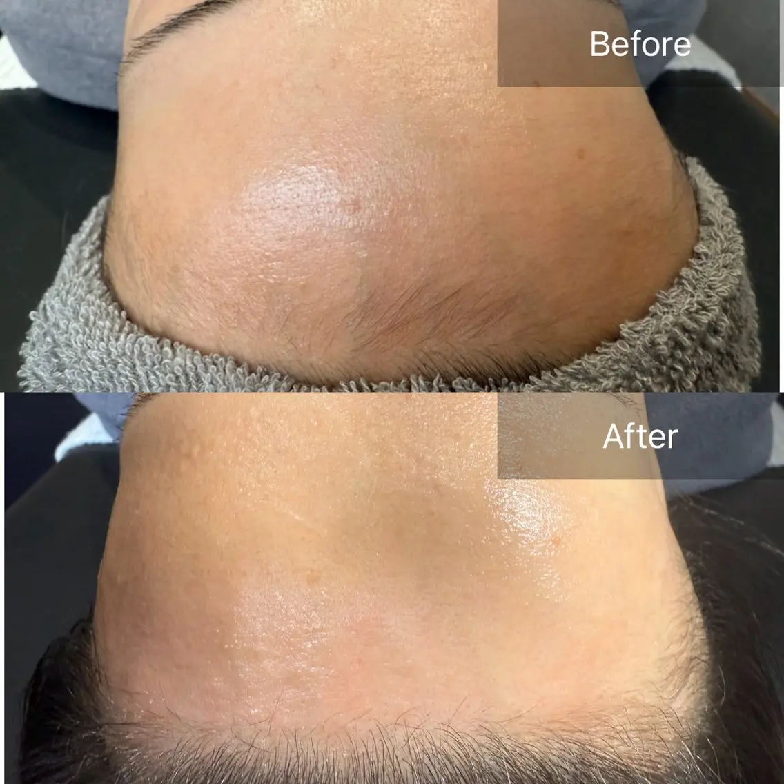 脱毛 enine フェイスWAXのエステ・リラクイメージ