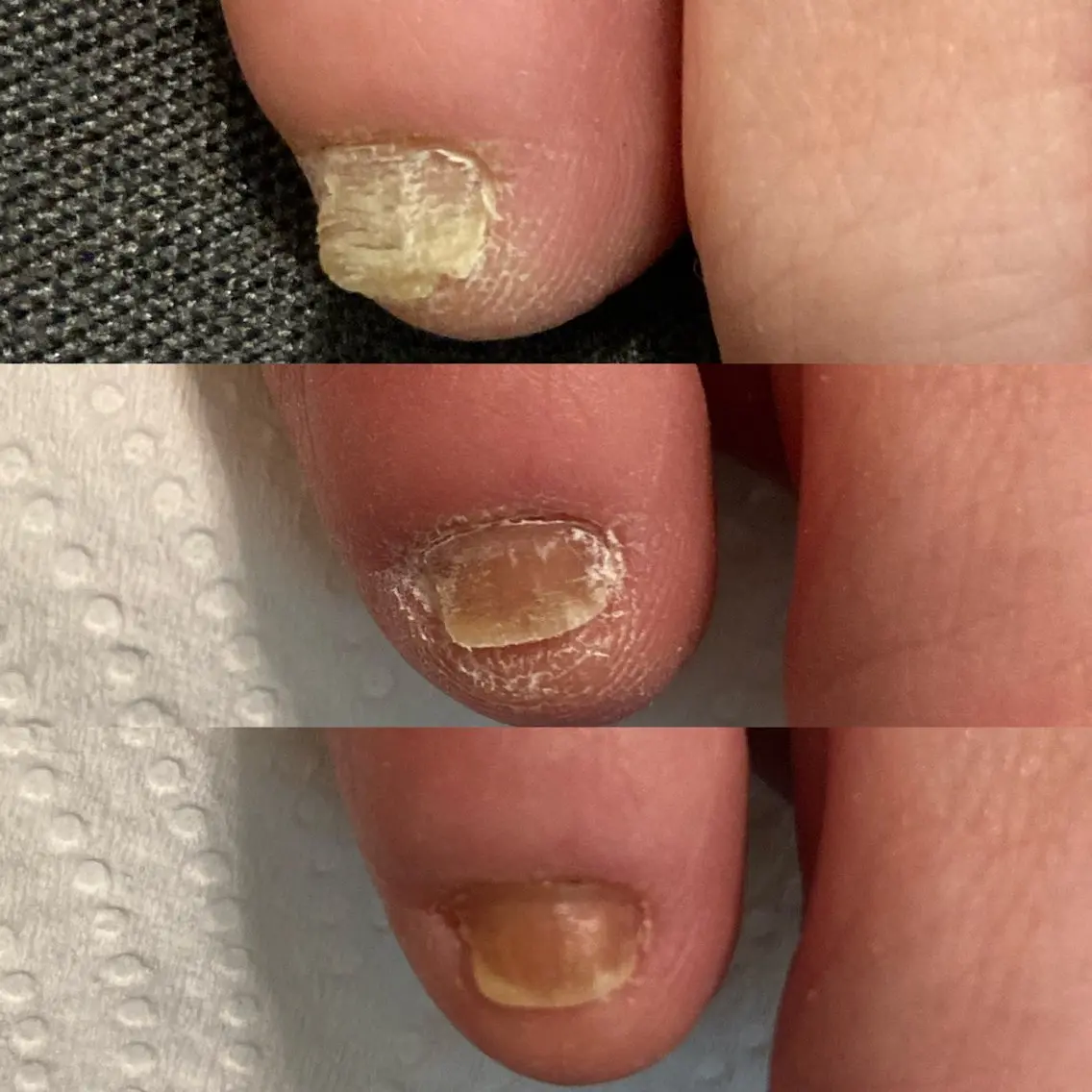 ネイル 地爪育成💅 kanaoanailのネイルデザイン