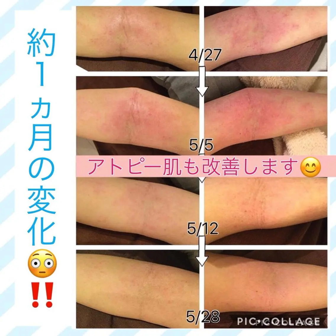 ミディアム カラー パーマ ヘアアレンジ メンズ キッズ ネイル マツエク・マツパ ニキビ・肌質改善専門 ♡人生が変わるサロンのエステ・リラクイメージ