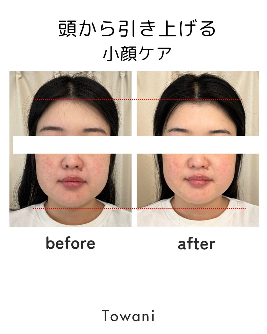 Towani 小顔・ビタミンケアのエステ・リラクイメージ