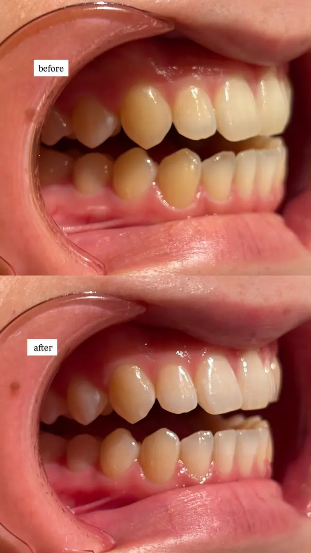 écrusmile ホワイトニングサロンのその他イメージ