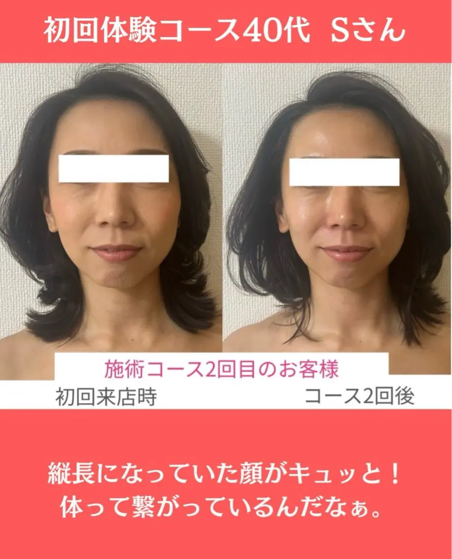 小顔サロン (ラ リュミエール)のエステ・リラクイメージ