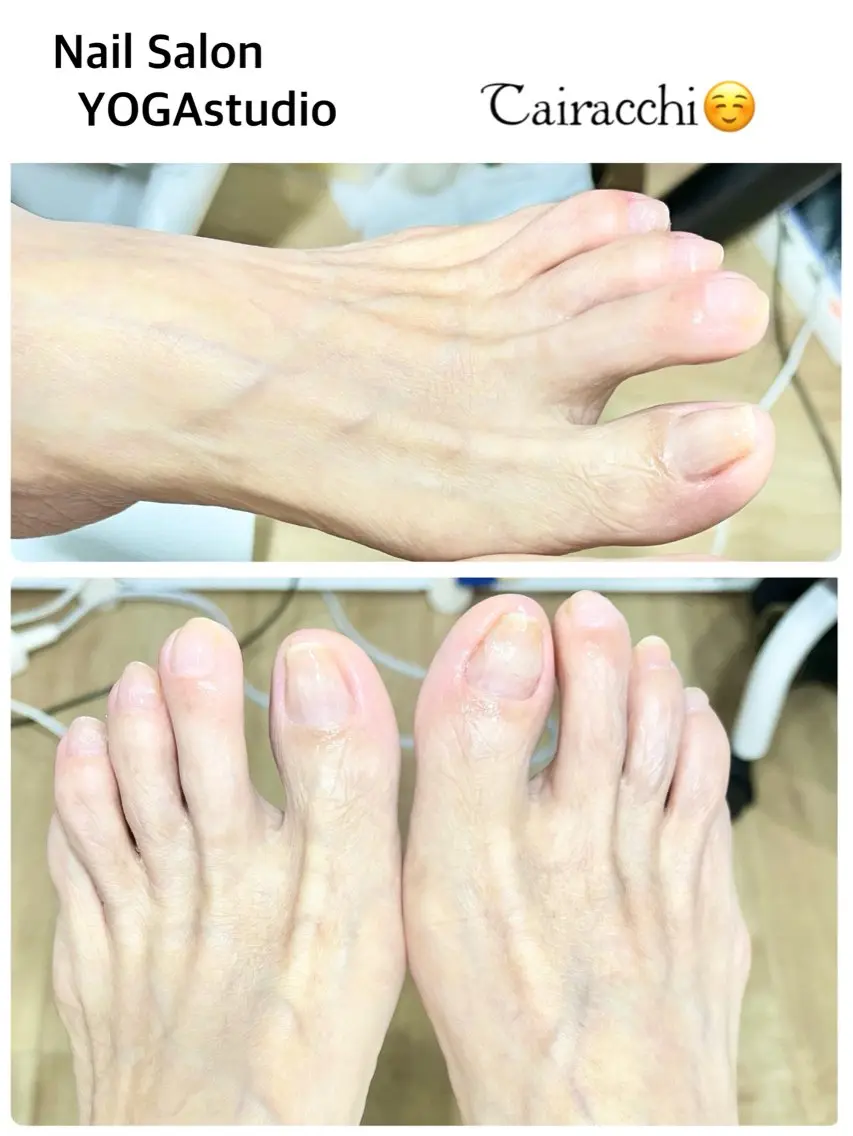 ネイル フットネイル キラキラネイル フットネイル Tairacchi タイラッチのエステ・リラクイメージ