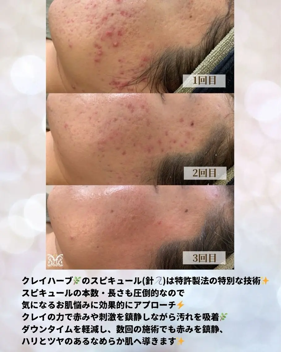エステ VIKI BEAUTYのエステ・リラクイメージ