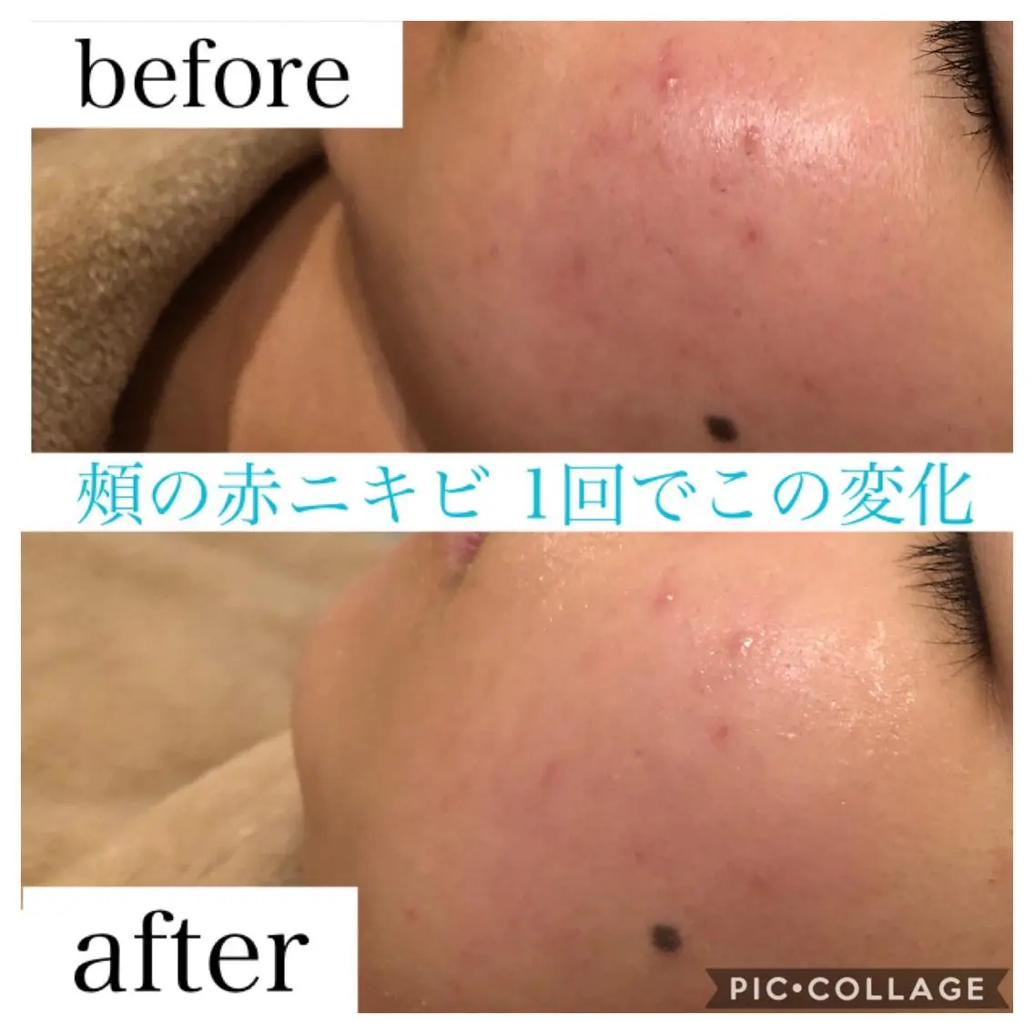 ロング カラー パーマ ヘアアレンジ キッズ ネイル マツエク・マツパ EnsorClair 代表 野口真央のエステ・リラクイメージ