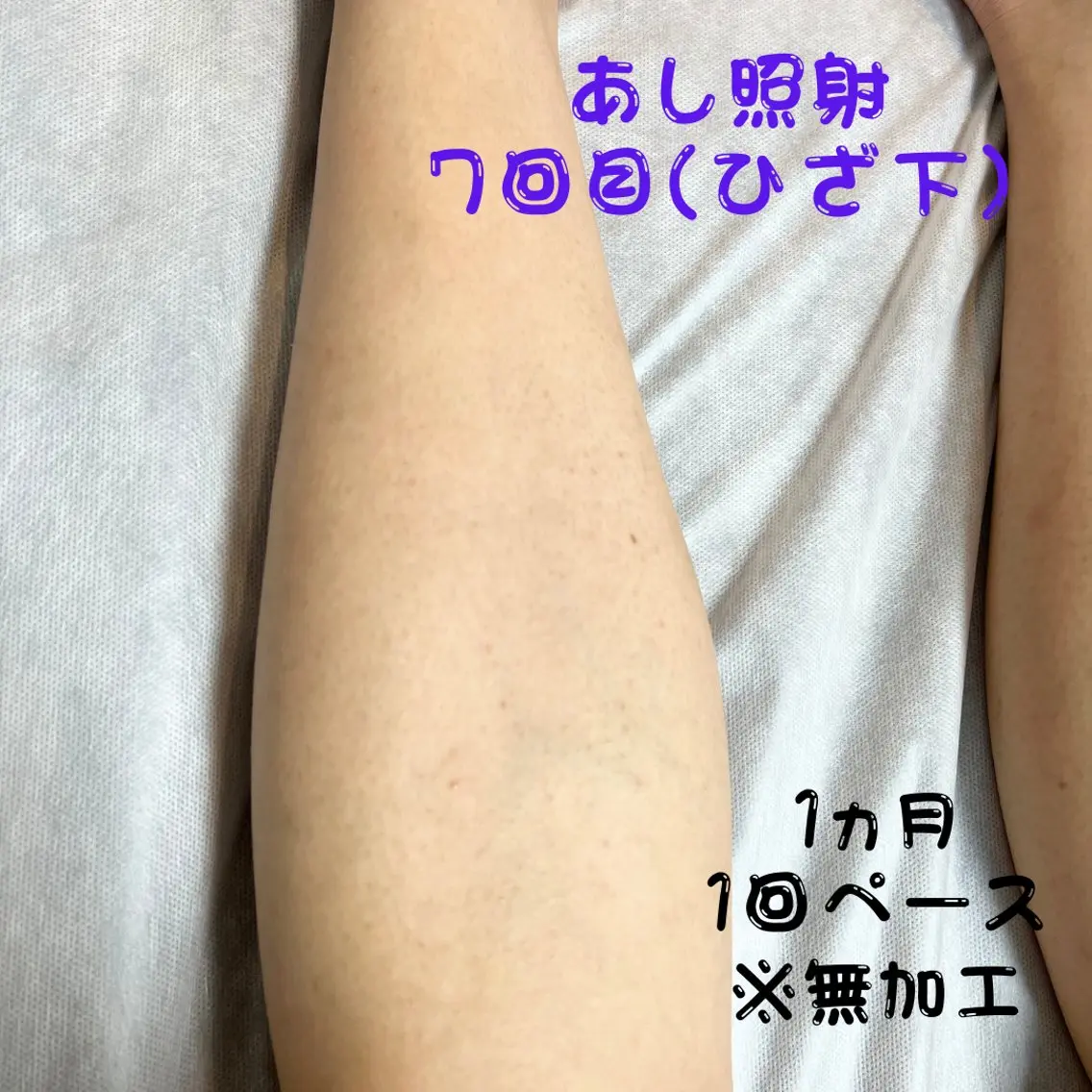 メンズ キッズ 脱毛 メンズ脱毛フェリッセ /男女🆗キッズ🆗のエステ・リラクイメージ