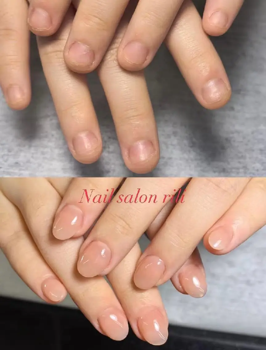 ネイル Natumiシンプル デザイン/深爪矯正のネイルデザイン