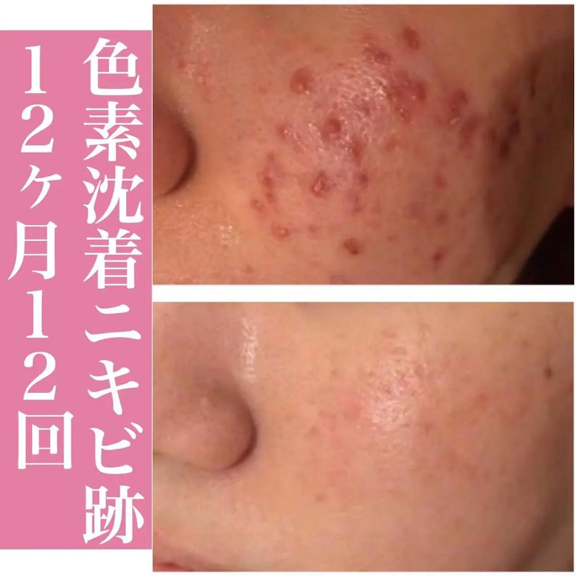 ロング カラー パーマ ヘアアレンジ キッズ ネイル マツエク・マツパ 美容まるっと ビヨマルのエステ・リラクイメージ