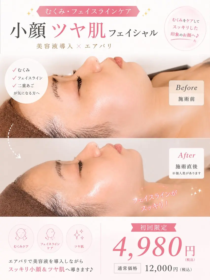 【むくみ・フェイスライン】小顔ツヤ肌フェイシャル☆通常¥12,000→初回限定¥4,980の写真