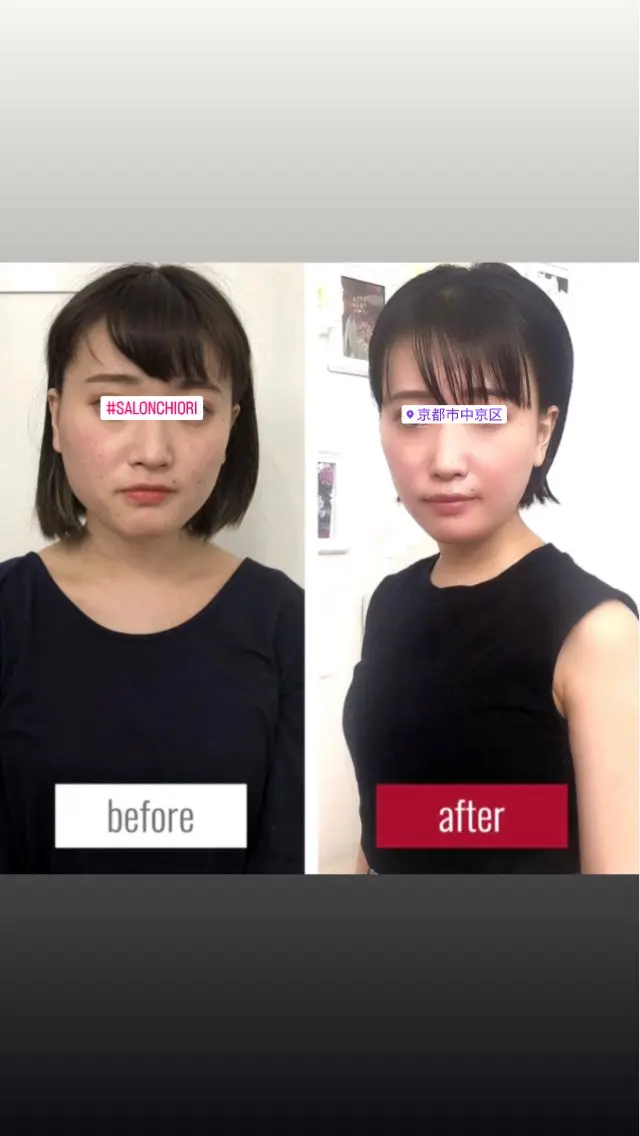【京都人気No.1】小顔矯正+身体＋姿勢矯正フルセット60分（通常¥19,980】の写真