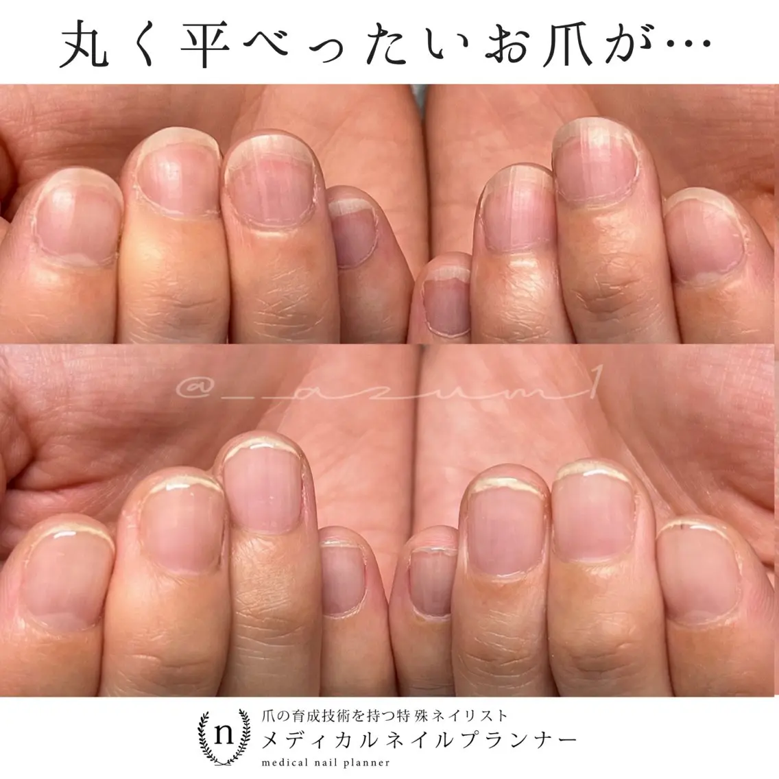 ネイル ハンドネイル 自爪育成専門サロン ◌𓈒azumiのネイルデザイン