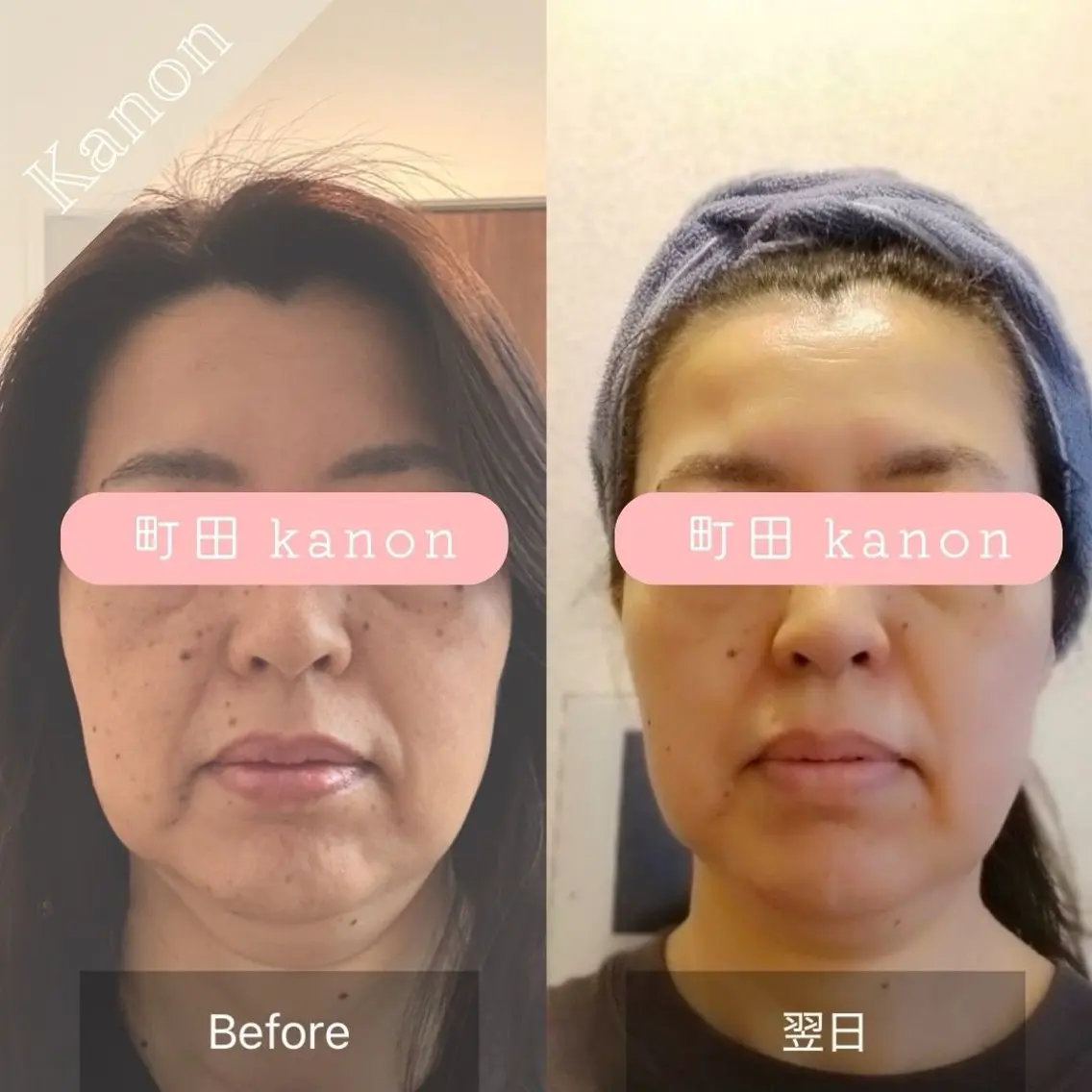 小顔矯正サロン町田 逸見智美のエステ・リラクイメージ
