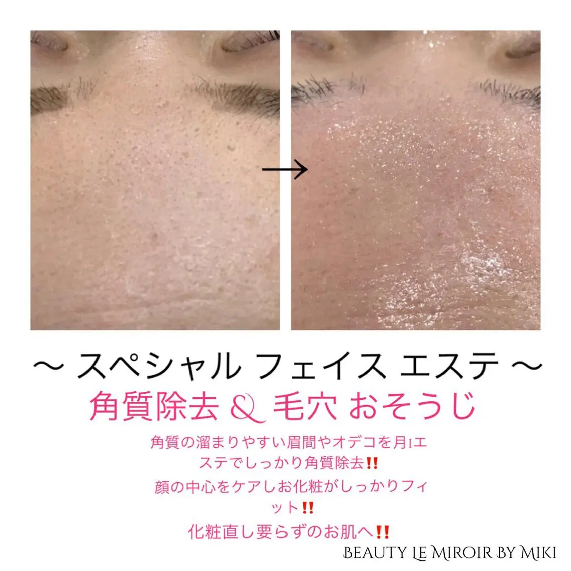 ビューティー ミロワールのエステ・リラクイメージ
