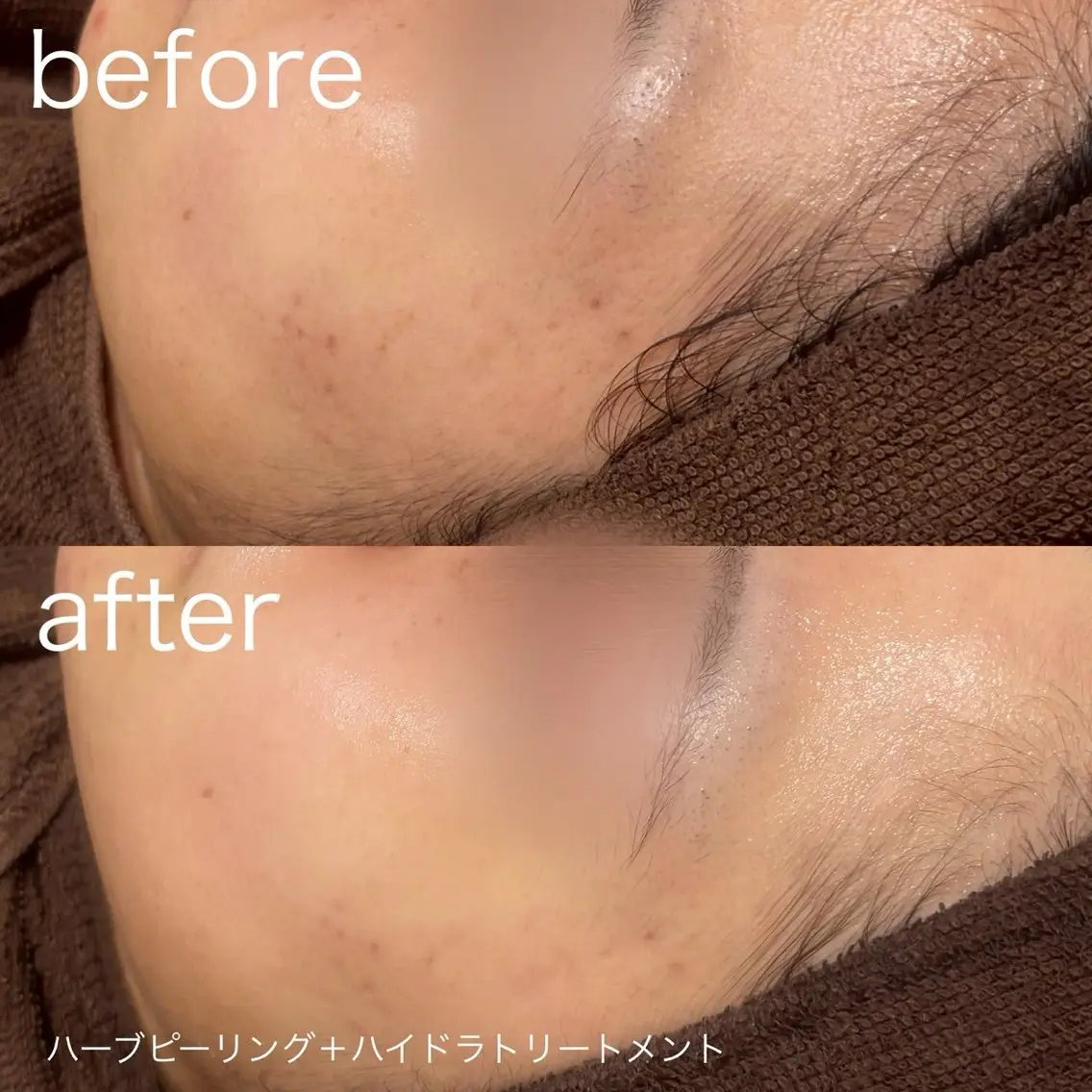 脱毛 lulularico Yuのネイルデザイン