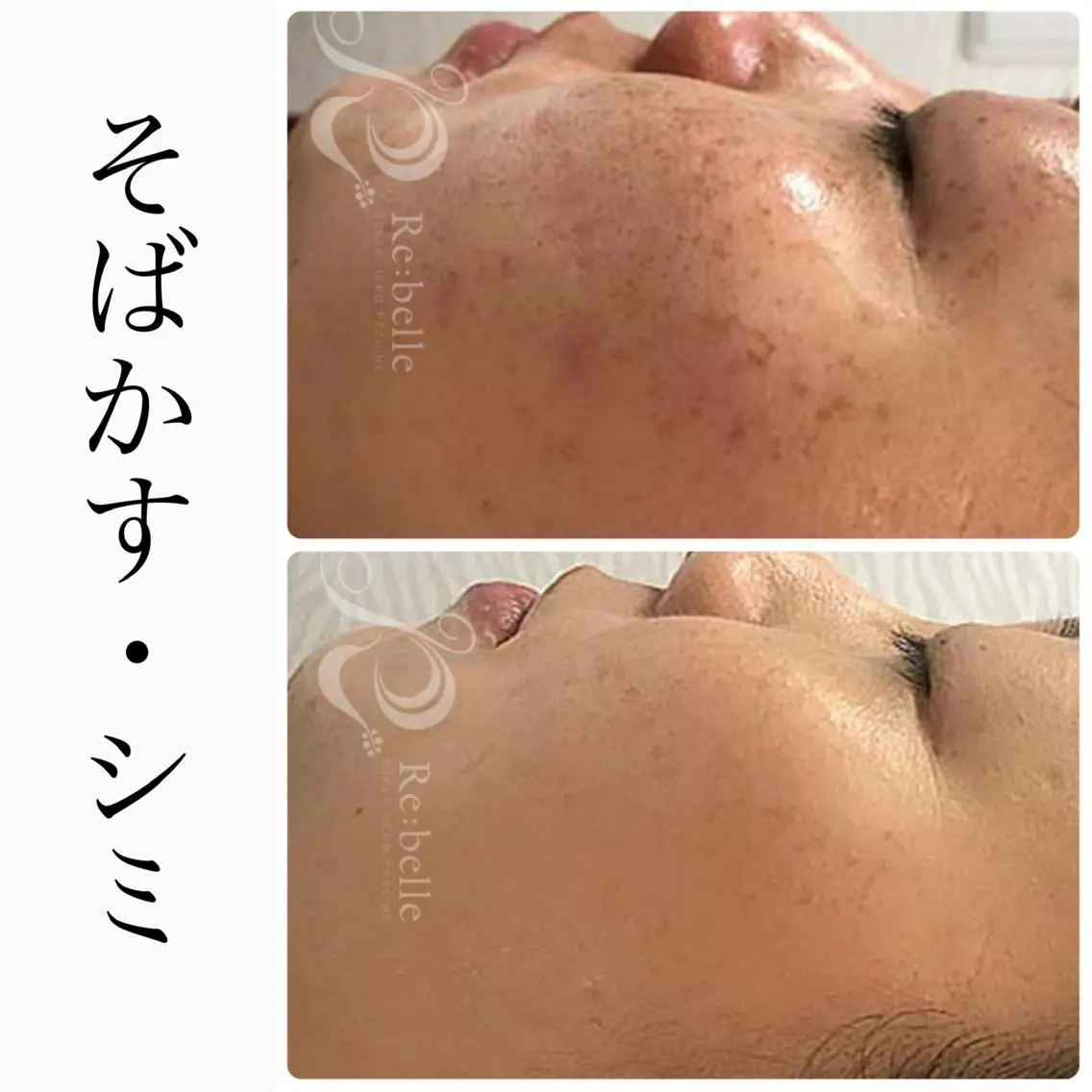 エステ ハーブピーリング専門 BIOEL横浜のエステ・リラクイメージ