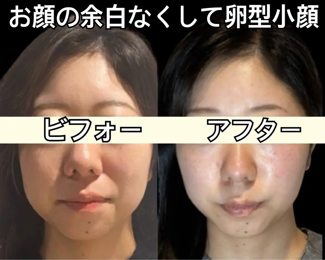 小顔と美肌サロン クリニカルサロンココのエステ・リラクイメージ