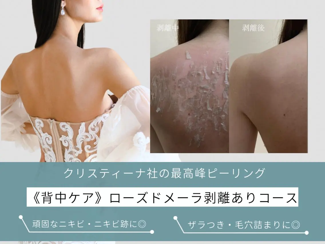 エステ 肌質改善ピーリング ✧BestBelleのエステ・リラクイメージ