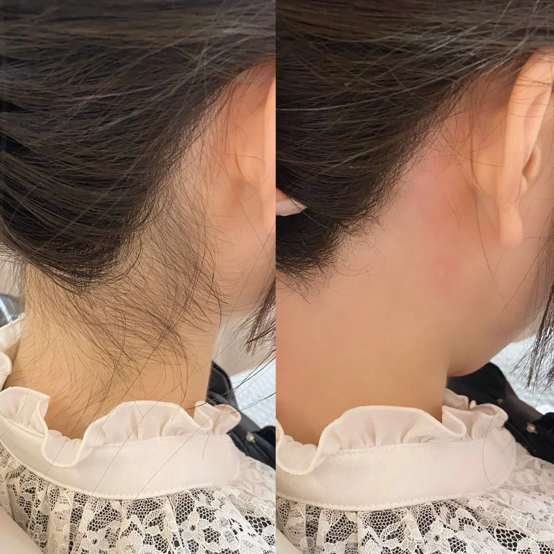 脱毛 🍒LOARK🍒 eyelash.大野のマツエク・マツパデザイン