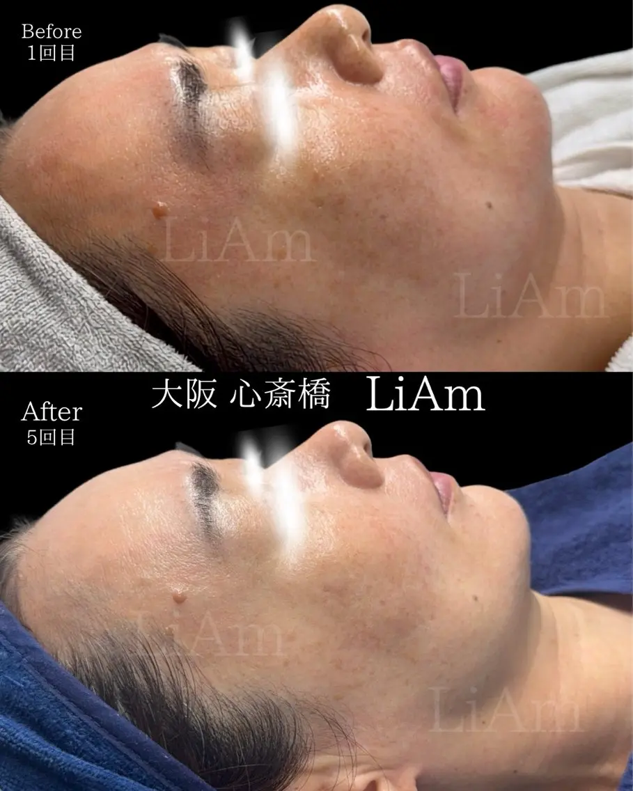 LiAm《韓国管理/ 小顔/脂肪ケア》のエステ・リラクイメージ