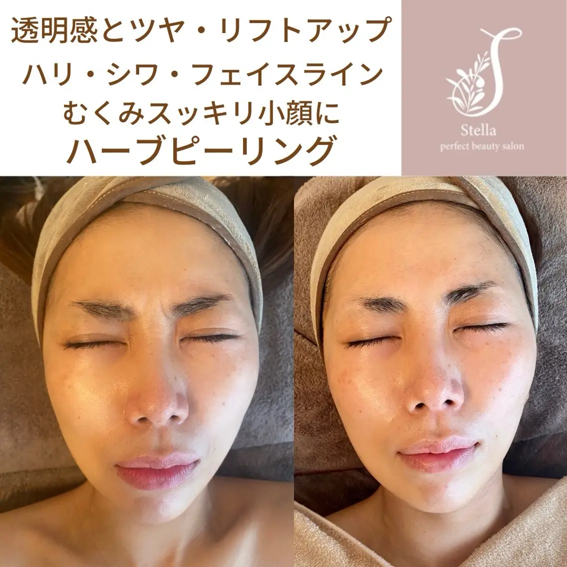エステ Salon Stellaのエステ・リラクイメージ