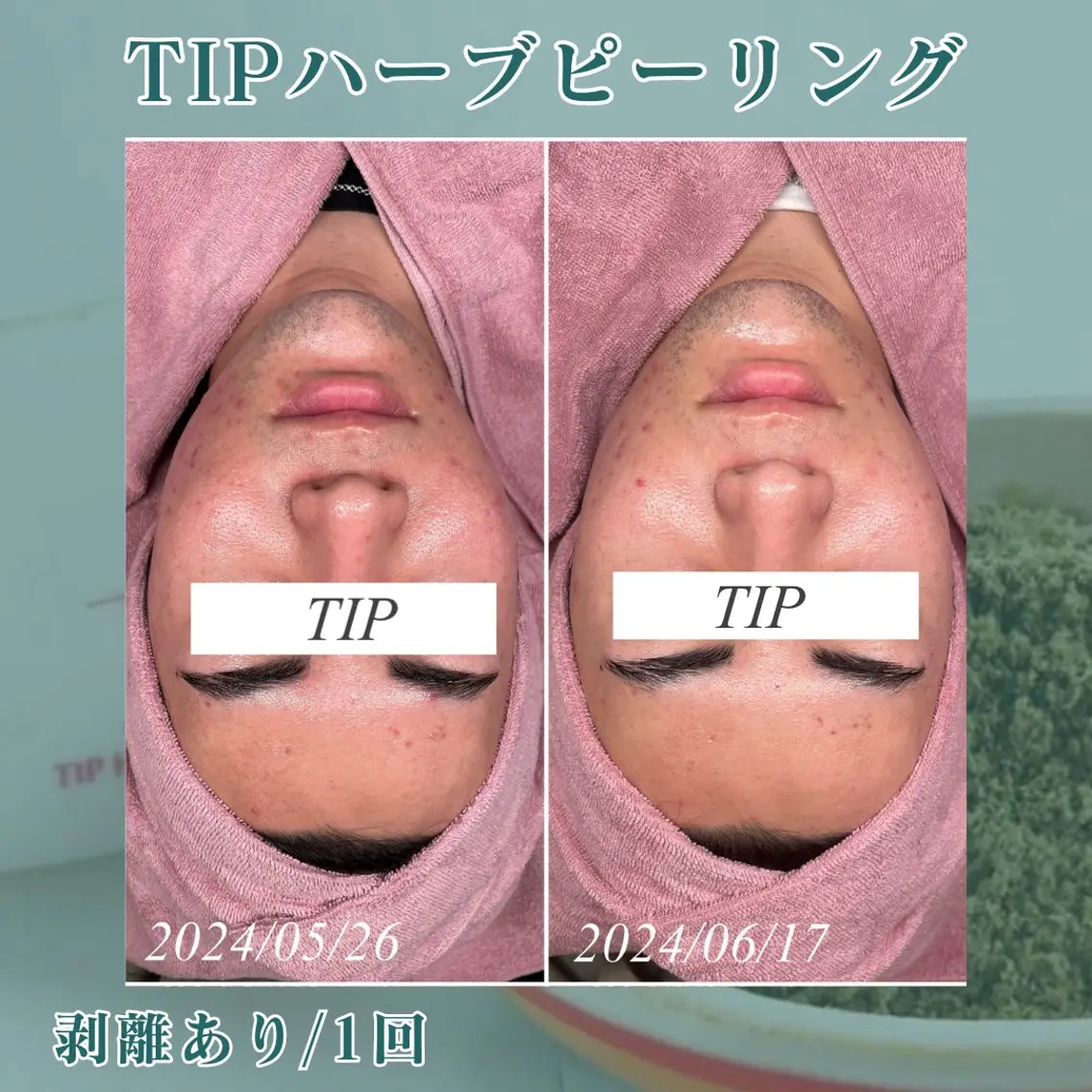 メンズ skin salon enのエステ・リラクイメージ