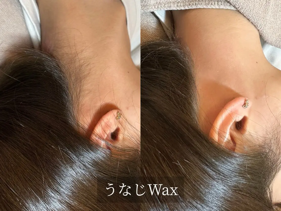 脱毛サロン Arumのエステ・リラクイメージ