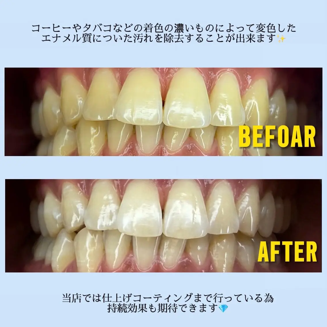 ホワイトニングサロン MAYUのその他イメージ