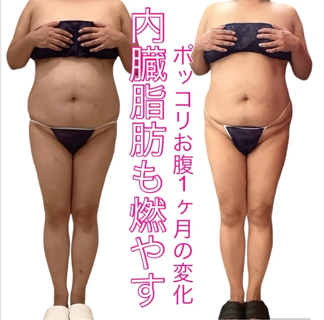 痩身ダイエット&小顔 🩷アールズスリムのエステ・リラクイメージ