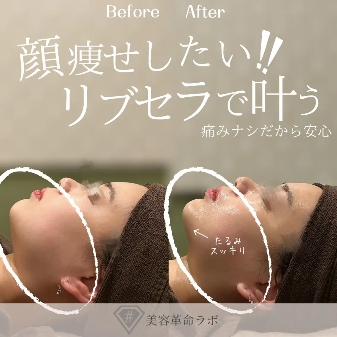 エステ 💎美容革命ラボ💎 大名店のエステ・リラクイメージ