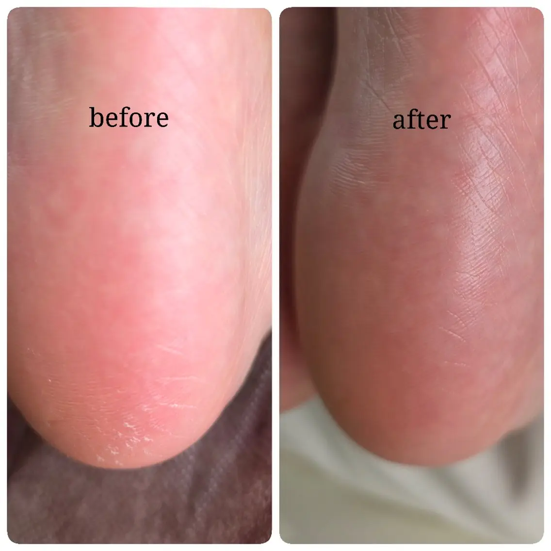 ネイル フットネイル Mrs Nailのネイルデザイン