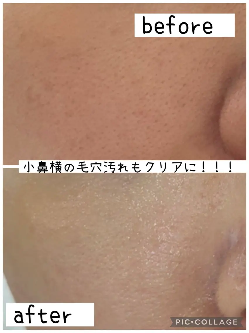 De I'm 堀のエステ・リラクイメージ