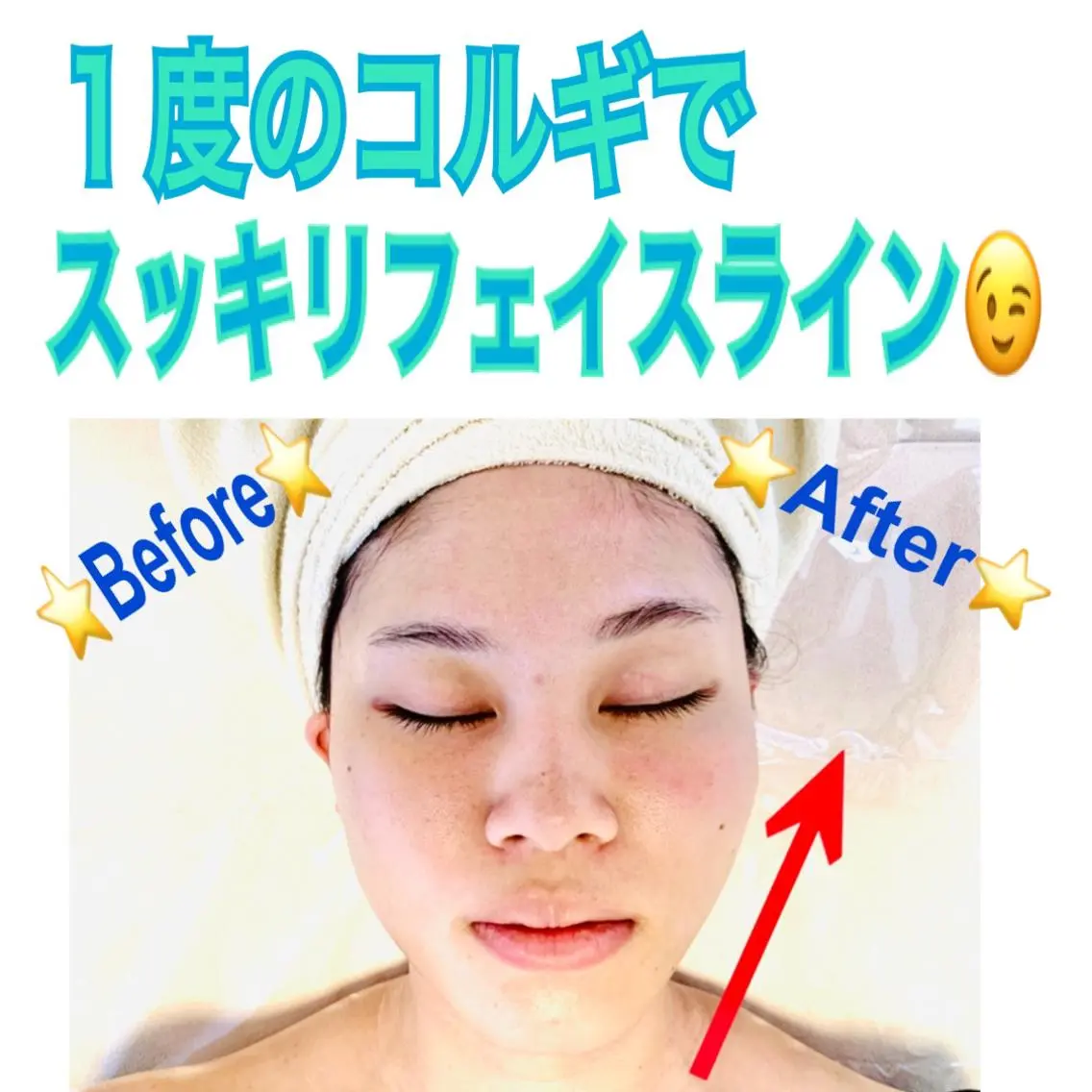 💎自分史上最高の小顔へ💞✨【U24割】ボディコルギ＋小顔コルギ60分💎ナチュラルに垢抜け💞ミニモ学割👩‍🎓の写真