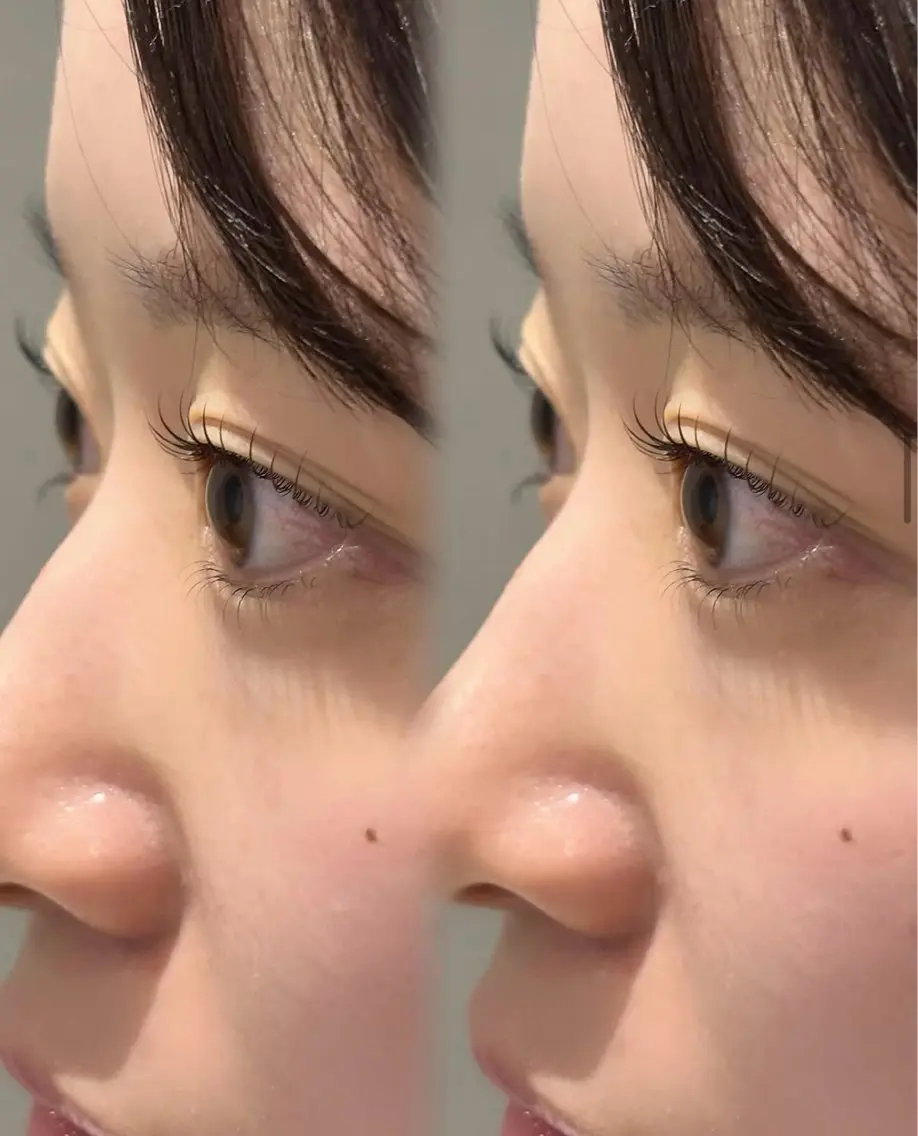 マツエク・マツパ 木全 鈴奈のマツエク・マツパデザイン