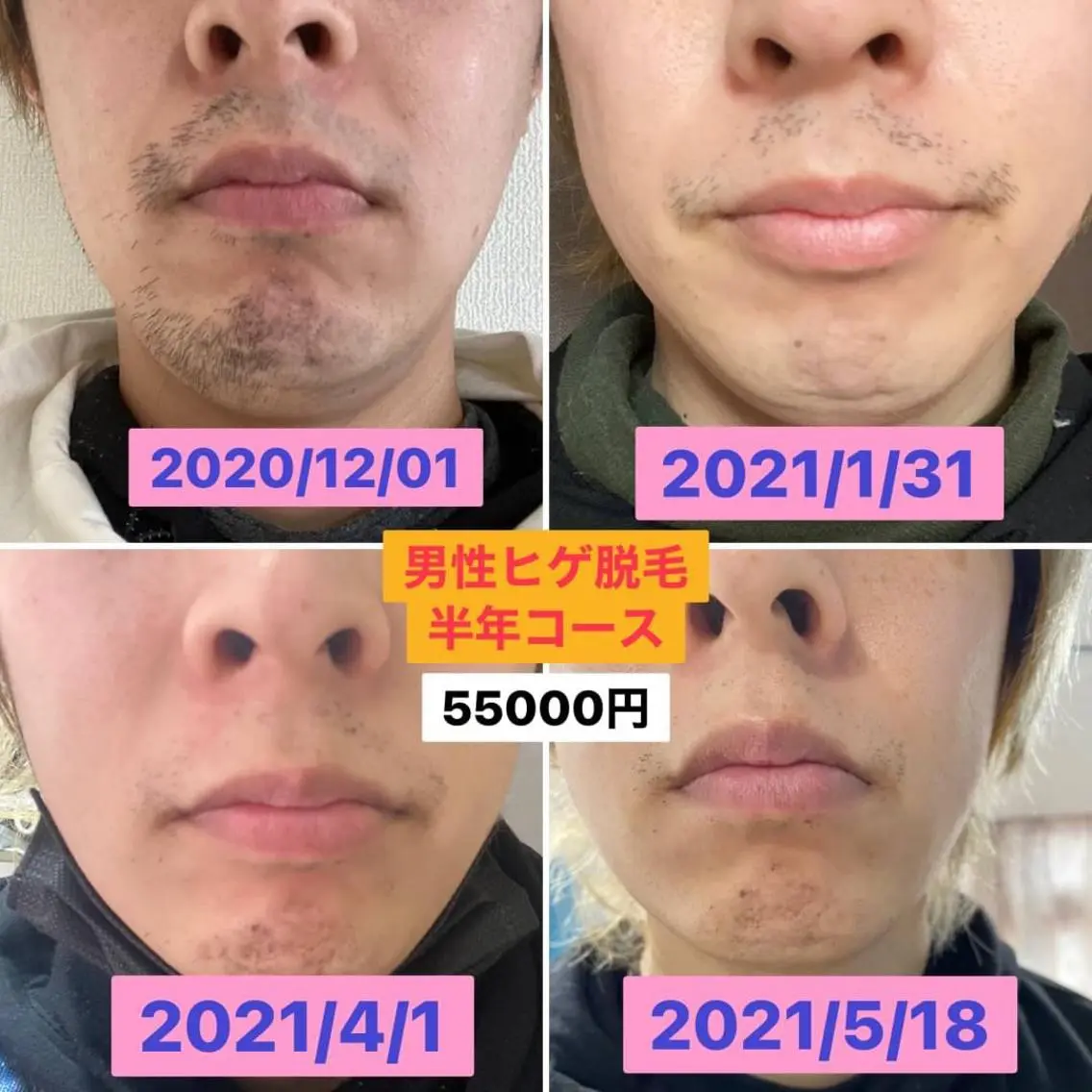 ショート メンズ くせ改善師 髪質改善師ゴトウのヘアスタイル