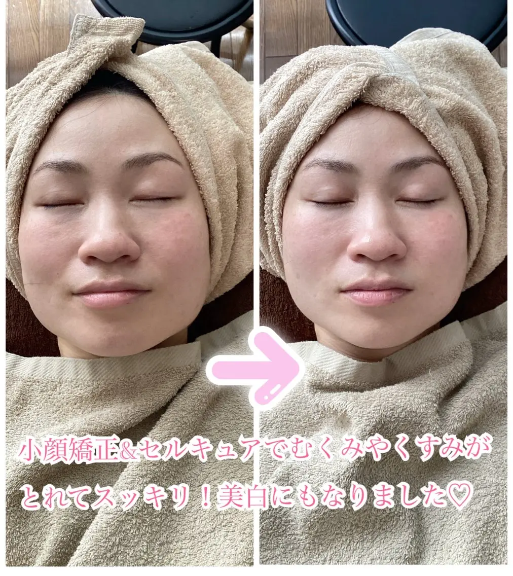 産前産後&美容整体 サロン【ブリーザ】のエステ・リラクイメージ
