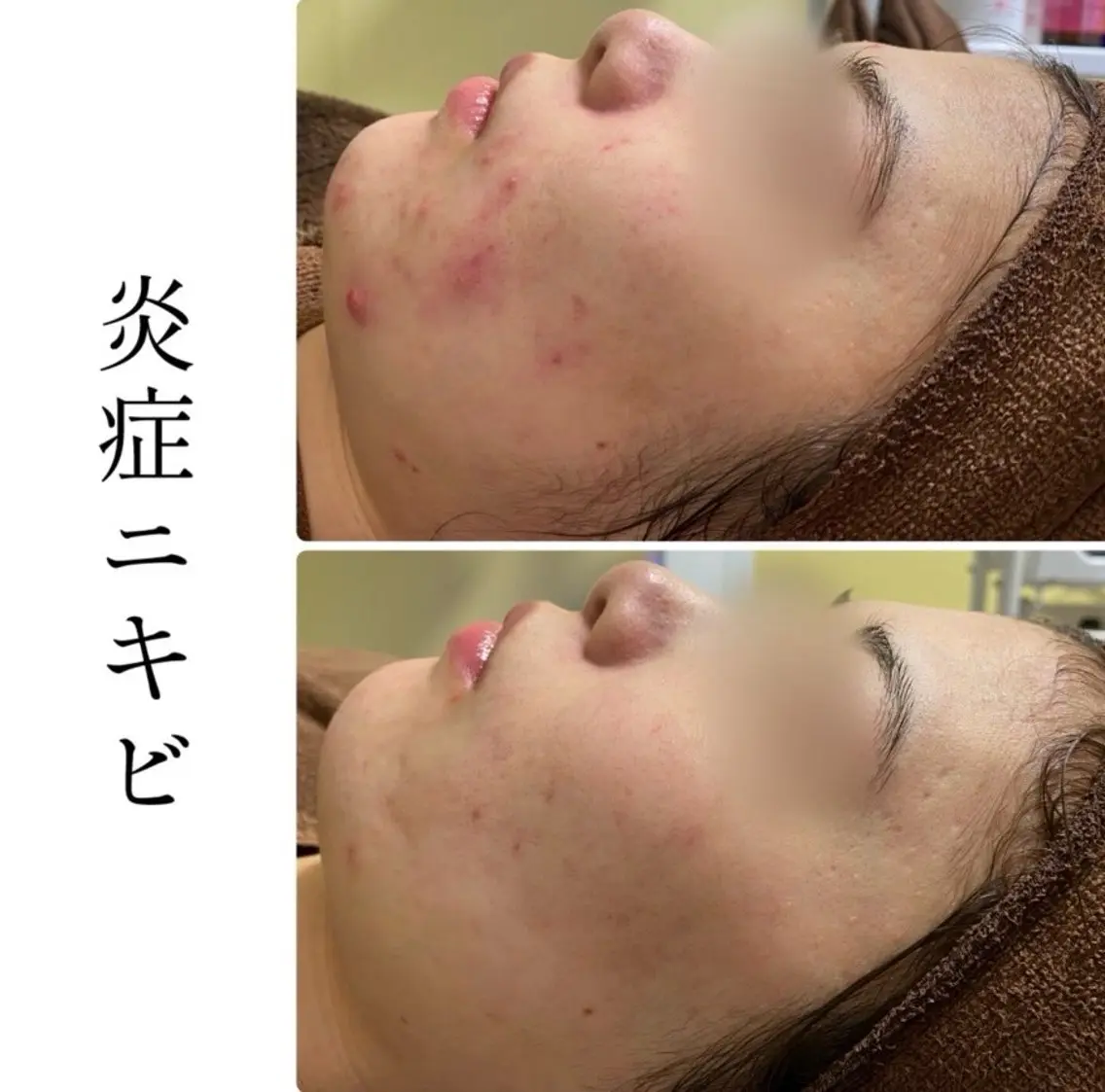 エステ ハーブピーリング専門 BIOPLUS+川崎のエステ・リラクイメージ